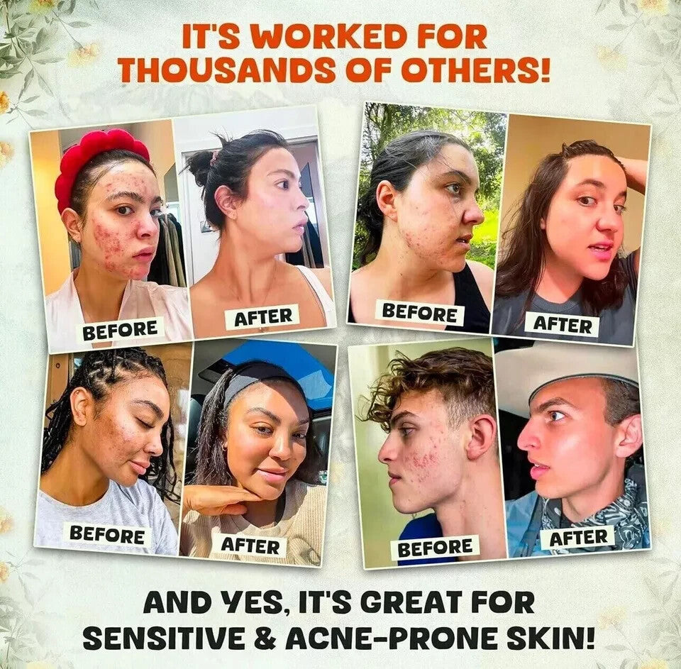 Evil Goods Whipped Beef Tallow + Manuka Honey Balm Moisturizer 4 Oz