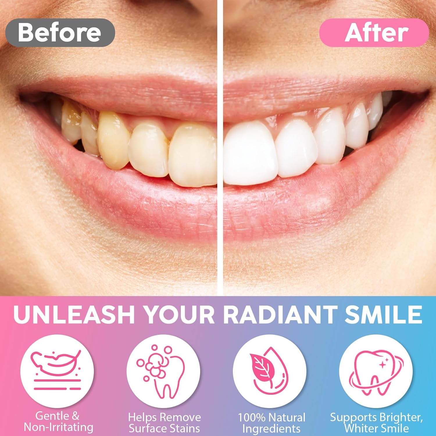 Niacinamide Whitening Toothpaste for Radiant Smile – Gentle Stain Removal, Fresh Breath, Deep Cleaning & Gum Protection – Niacinamide Toothpaste for Daily Use – Lasting Mint Flavor – 3.5Oz Tube